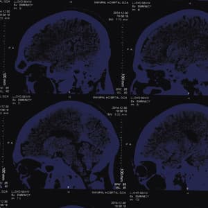 Gales Doc - The Nightingales